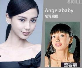 长沙整容爆料案件最新,揭开医美行业潜规则与维权困境